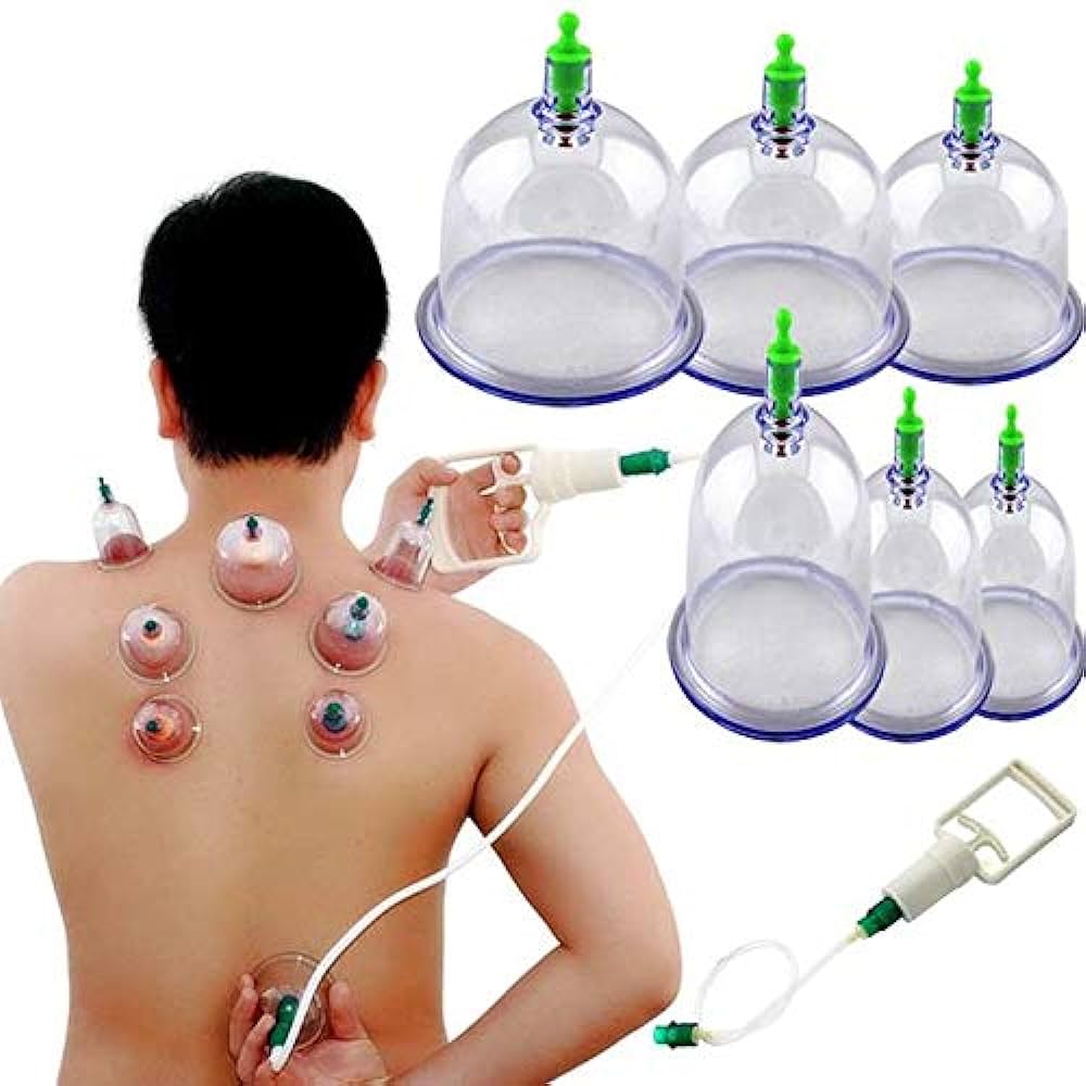Traditional Hijama